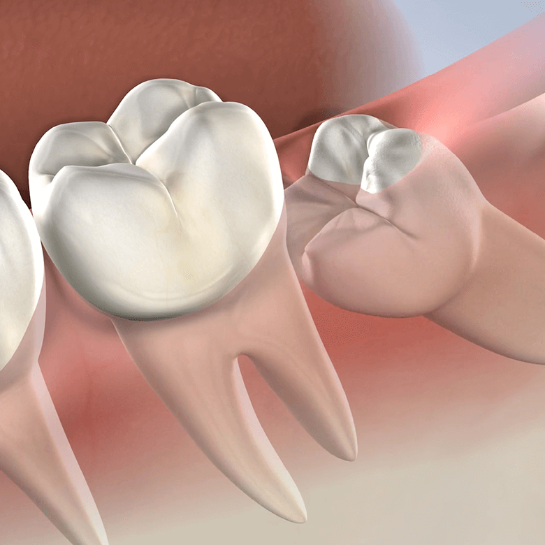 MAXILOFACIAL